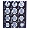 Buy cheap 10in * 14in Digital x-ray Dry Medical Imaging Films For Thermal Printers KND-F from wholesalers