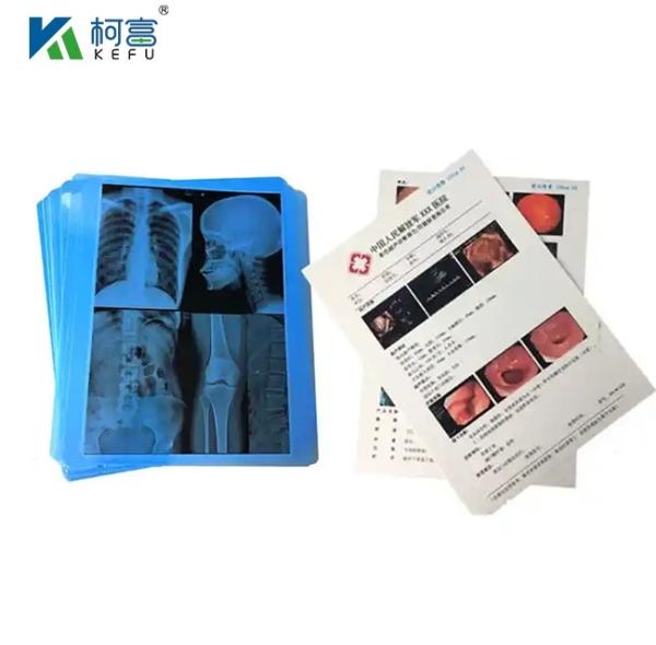 Buy cheap CT Scanner Dry X-Ray 24x30 Inch Film Inkjet Green Blue Base Medical X Ray Film from wholesalers