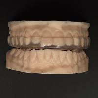 Buy cheap Clear Hard Soft Orthodontic Night Guard Breathability Heavy Duty Protection product