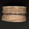 Buy cheap Clear Hard Soft Orthodontic Night Guard Breathability Heavy Duty Protection Occlusal Splint Hard/Soft from wholesalers