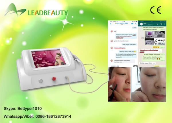 Quality 30MHZ High Frequency skin tag remove / facial veins removal / red blood cure for sale