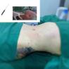 Buy cheap GOMECY Vascular Removal Clinic 980nm Diode Laser Nail Fungus Treatment from wholesalers