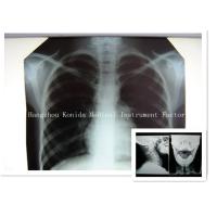 Buy cheap Digital Medical X Ray Dry Film 14 x 17inch Health Imaging Radiographic Film product