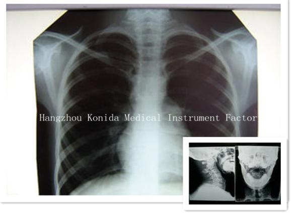 Buy cheap Digital Medical X Ray Dry Film 14 x 17inch Health Imaging Radiographic Film from wholesalers