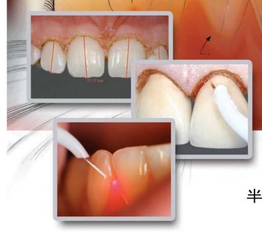 Buy cheap teeth whitening light/dental laser teeth white machine from wholesalers