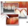 Buy cheap teeth whitening light/dental laser teeth white machine from wholesalers