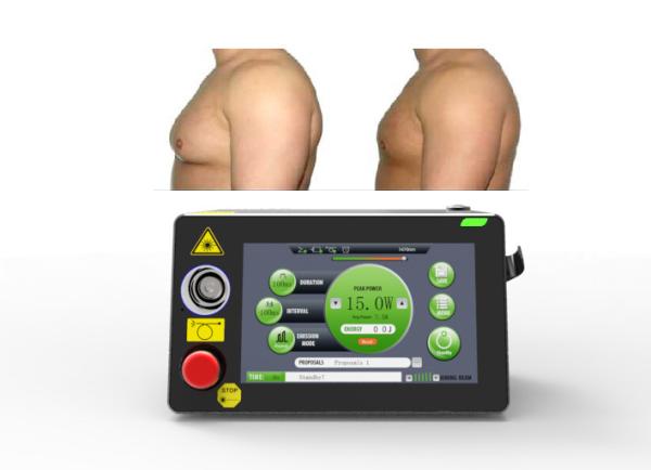 Buy cheap 16W Laser Lipolysis Machine Gynaecomastia Treatment Minimally Invasive from wholesalers
