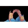 Buy cheap 3D Print Model Dental TCS Valplast Flexible Partial Dentures Pink / Dark Color Dental Lab Product from wholesalers
