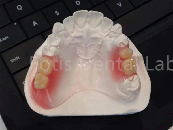 Buy cheap Flexible TCS Valplast Dental Appliances Comfortable Durable Design from wholesalers