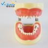Buy cheap Advance PVC Plastic Child Caries Teeth Model Dental Life Size Eco - Friendly from wholesalers