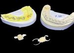 Natural Looking Dental Ceramic Crown HPP Bonded Ceramic Bridge Easy Cleaning