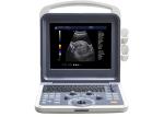 Buy cheap 12 Inch LED Portable Ultrasound Scanner Color Doppler 4D Ultrasound Machine from wholesalers
