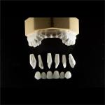 Dental Lab Teeth Feldspathic Porcelain Veneers Custom Shaped