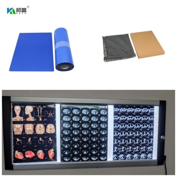 Buy cheap Blue Base Dry Inkjet Medical X Ray Films DR CT MRI Dye Ink 8x10 A4 A3 100 Sheets from wholesalers