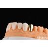 Buy cheap Wax Casted Gold 60K Metallic Dental Crowns Abrasive Resistant Gold Tooth Crown from wholesalers