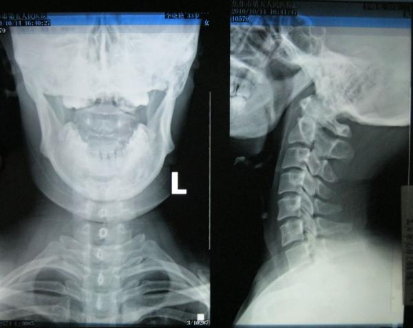 35cm * 43cm Glossy Medical Dry Imaging Film For Fuji 3000, 2000, 1000, Thermal
