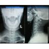 Buy cheap 35cm * 43cm Glossy Medical Dry Imaging Film For Fuji 3000, 2000, 1000, Thermal Printer from wholesalers