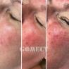 Buy cheap M22 Ipl Opt Machine Intense Pulsed Light For Hair Removal Skin Rejuvenation from wholesalers