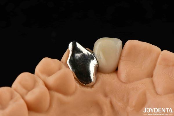 Buy cheap Customizable Metallic Material PFM Maryland Dental Care Oral Clinical Repair from wholesalers