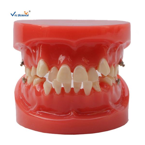 Buy cheap Orthodontic Dental Study Models Tooth Teaching , Dental Models For Patient Education from wholesalers