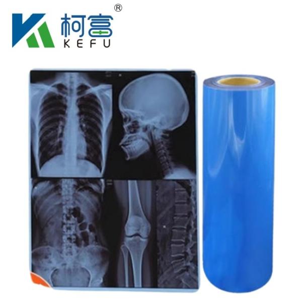 Buy cheap Waterproof Medical X-Ray Thermal Film X Ray Blue Film For Inkjet Printers from wholesalers