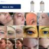 Buy cheap Facial Plasma Shower Machine 3 Handles For Acne Removal And Face Lifting from wholesalers