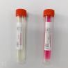 Buy cheap Viral Transport Media Specimen Collection Kit Flocked Swab Ebola Influenza from wholesalers