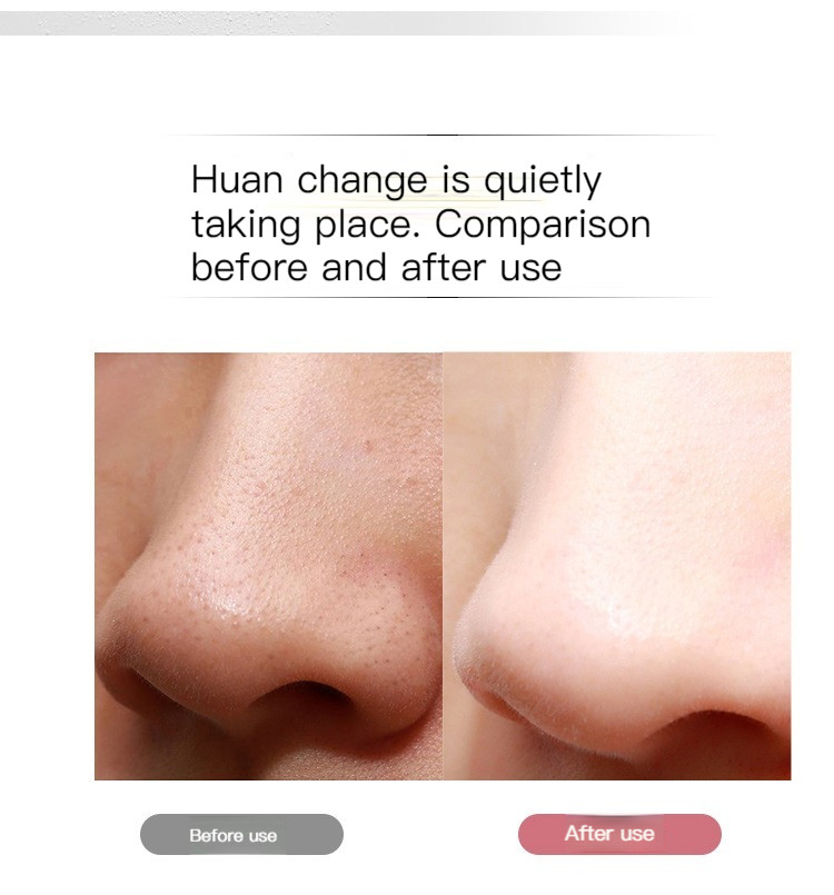 Plastic Portable Ultrasonic Skin Scrubber Professional 300g Blackhead Remover Scrubber