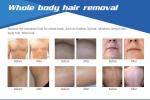 Salon use hair removal machine for face professional ipl laser hair removal and