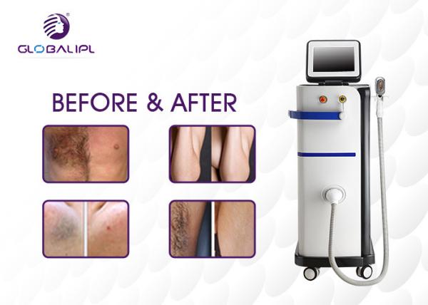 Buy cheap Micro Channel 808 400ms Diode Laser Hair Removal Machine from wholesalers