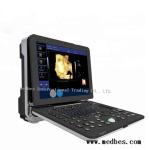 Hot Color Doppler Ultrasound Diagnosis System