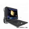 Buy cheap 4D Realtime Musculoskeletal Ultrasound Systems fetal doppler ultrasound Ultrasound Diagnosis System from wholesalers
