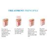 Buy cheap Professional ice soprano laser diode device hair removal triple wave medical laser on sale from wholesalers
