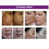 Buy cheap Photodynamic Therapy Machine With 3 Color Red&Blue LED Light For Face Skin Treatment from wholesalers