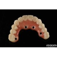 Buy cheap Quick Drying Titanium Bar Acrylic Teeth Finishing Clear Acrylic Teeth Dental product