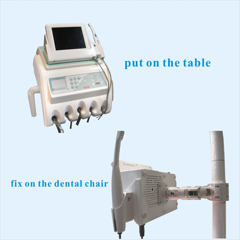 Dentist Intra Oral Camera 8 Mega Mouth Mirror Scanner Endoscope With 8 Inch Monitor