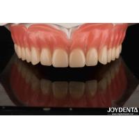 Buy cheap Acrylic Teeth Finish Lightweight Resin Material Dental Restorations Tooth product