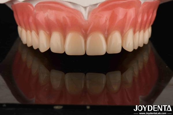 Buy cheap Acrylic Teeth Finish Lightweight Resin Material Dental Restorations Tooth Arrangement from wholesalers