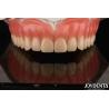 Buy cheap Acrylic Teeth Finish Lightweight Resin Material Dental Restorations Tooth Arrangement from wholesalers