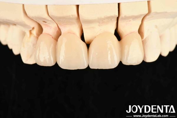 Buy cheap High Translucency Layered Zirconia 3 W/mK Thermal Conductivity For Exceptional Performance from wholesalers