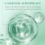 30ml Anti Acne Face Serum Organic Acne Treatment Salicylic Acid Pimple Removal