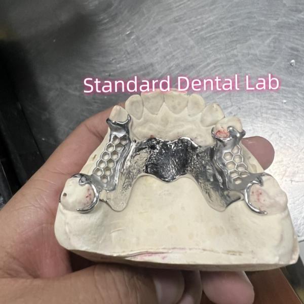 Buy cheap Cobalt Chrome Cast Frame Partial Denture Vitallium 2000 from wholesalers