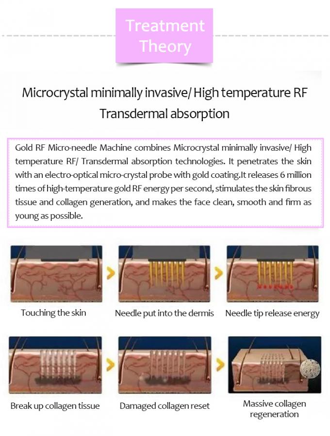 Skin Tightening Devices Wrinkle Reduction Salon & Clinic RF Beauty Equipment 0