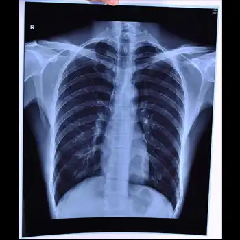 Max Density 3.0D X Ray Film 200±5μM Thick For Accurate And Detailed Medical Imaging