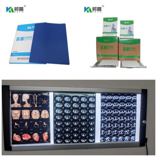 Buy cheap DR CT MRI Medical Inkjet Dry X Ray Films 280gsm Dye Ink 8x10 13x17 A4 A3 Sheets from wholesalers