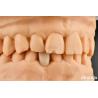 Buy cheap Ideal Matching Clinical Bonding Maryland Dental For Oral Clinical Repair Work from wholesalers