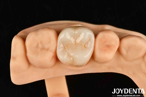 Buy cheap High Wear Resistance Dental Full Zirconia High Strength Full Contour Zirconia Bridge from wholesalers