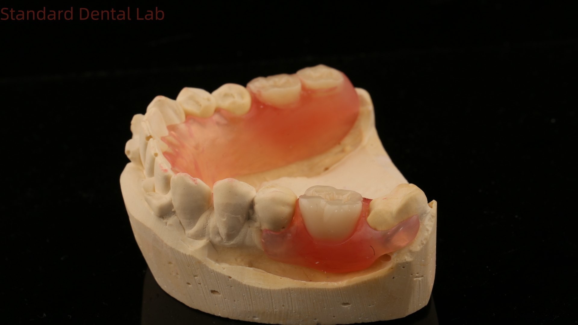 Dental TCS Valplast Flexible Partial Dentures Nesbit Valplast Finish China Dental Lab Valplast Clasp