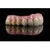 Buy cheap China Dental Lab All On 4 Bridge Full Arch Implant Bridge In Demistry from wholesalers