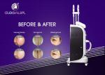 Multifunctional IPL SHR Hair Removal Machine , Medical Laser Hair Removal